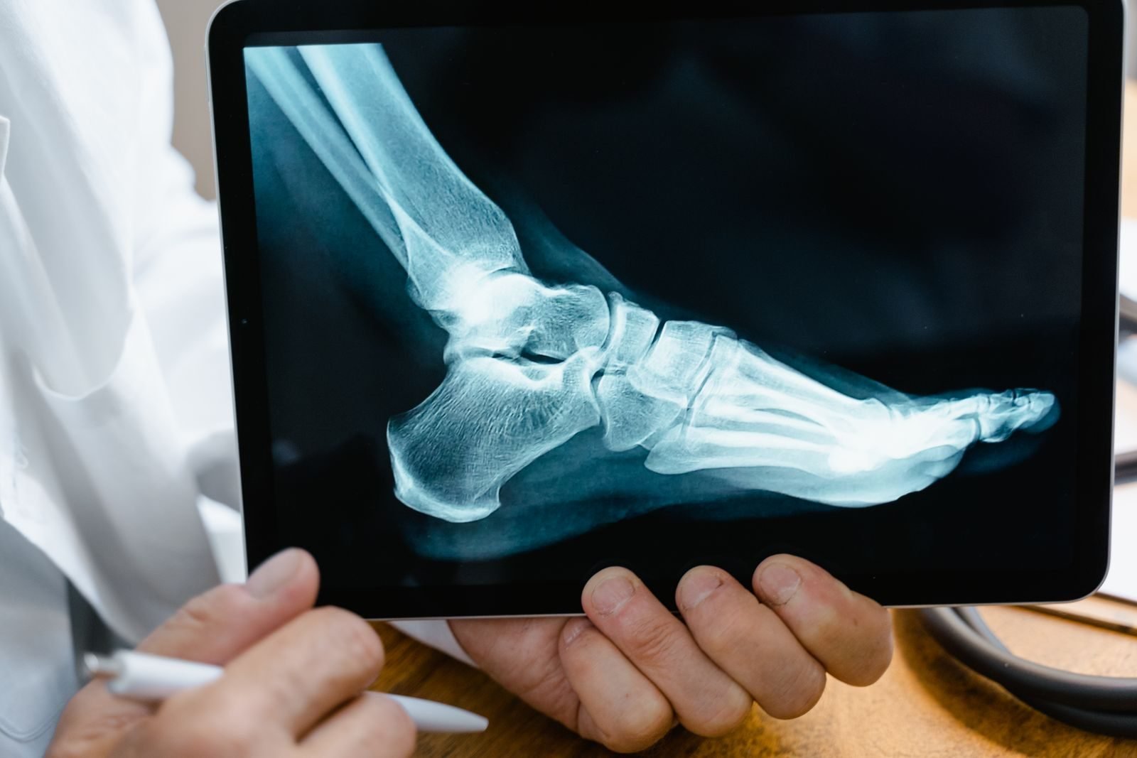 Consulta médica con la imagen de un pie en una tableta