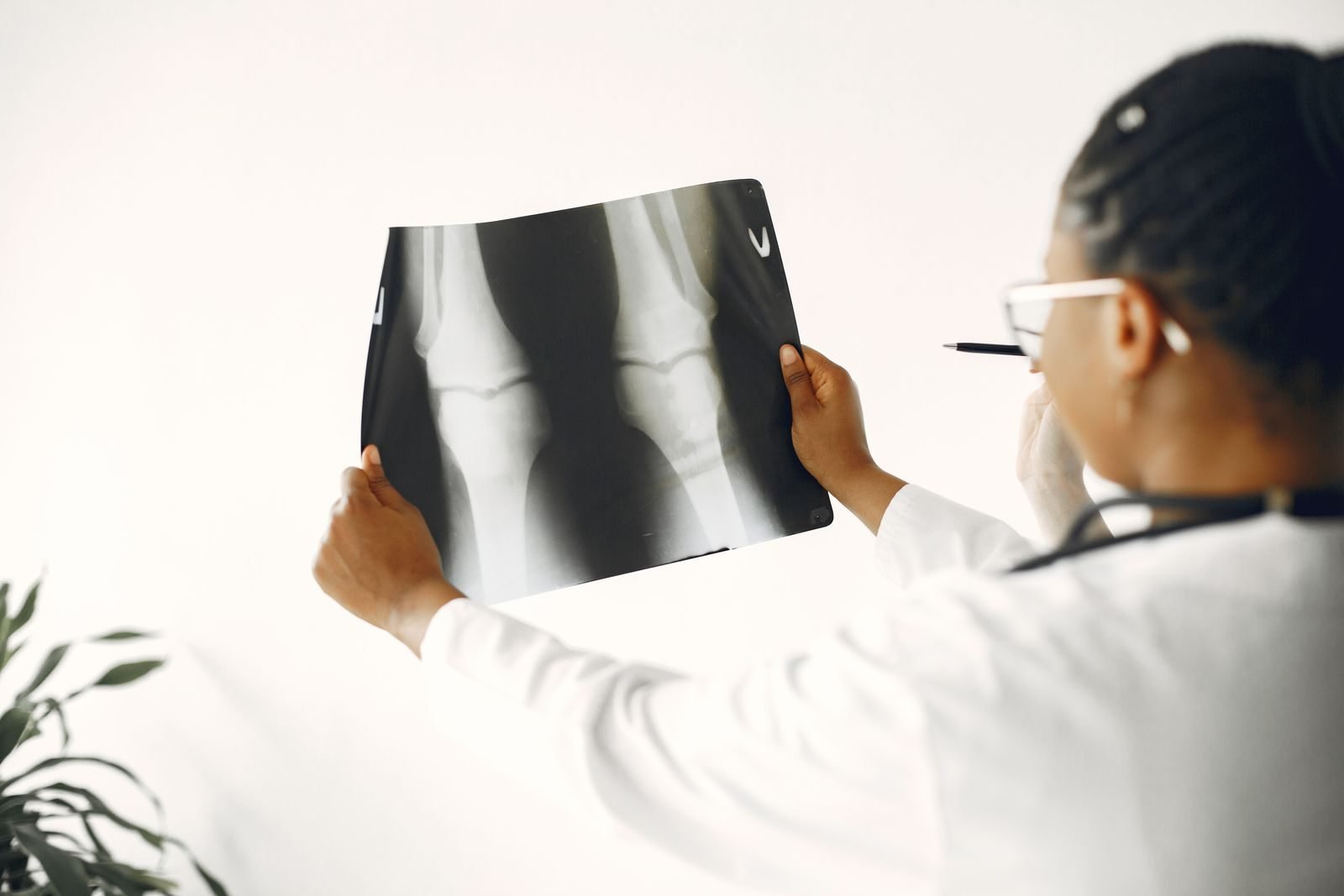 Doctor reviewing a knee X-ray, the injury Ruti Aga said she was treating