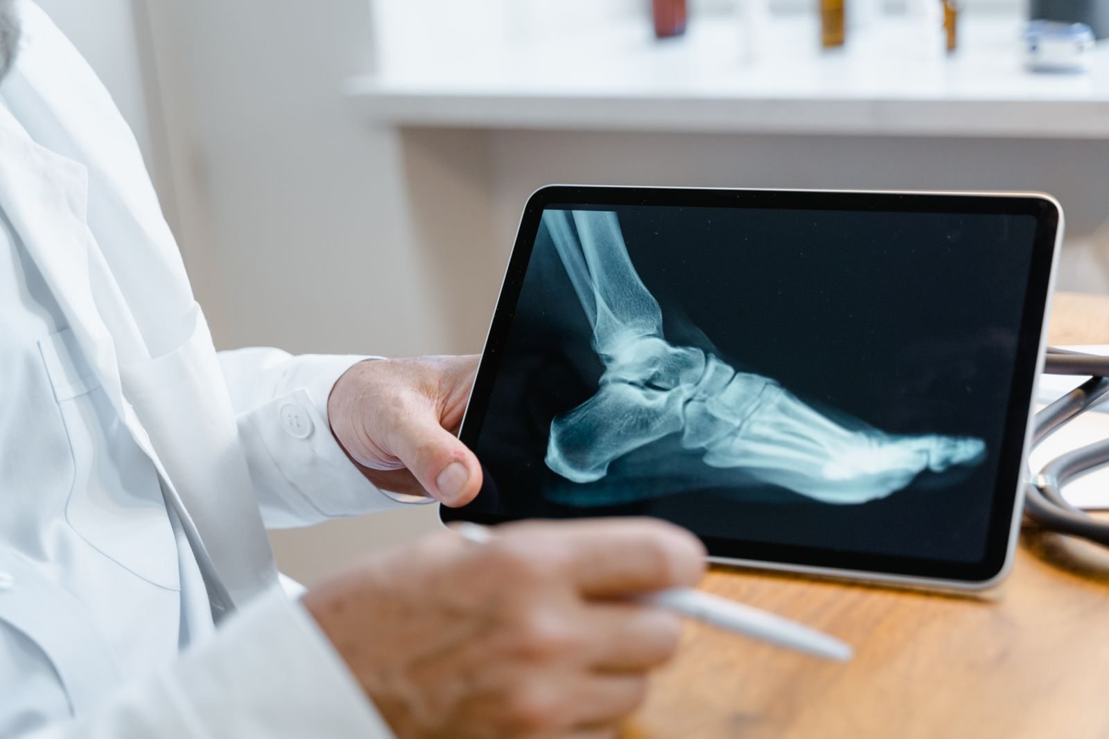 Médica revisando la imagen de un pie en una tableta durante la consulta, como en el estudio del tendón de Aquiles en corredores