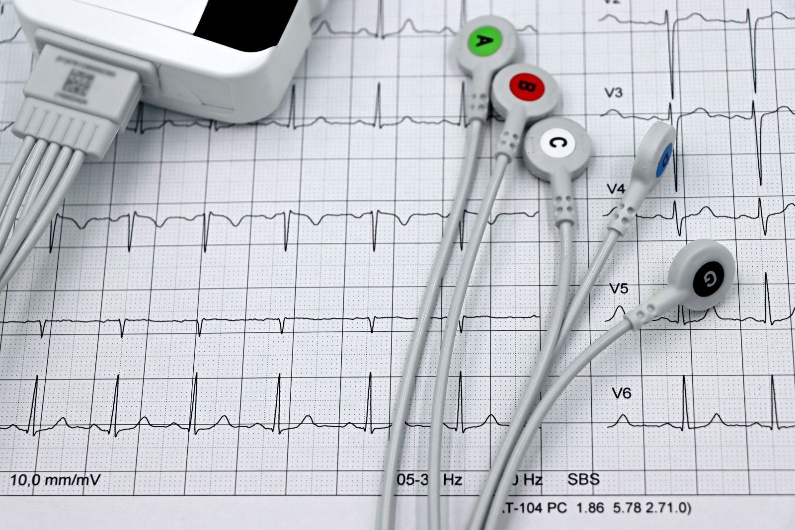 Electrodos sobre un electrocardiograma, la base de las zonas de frecuencia cardíaca